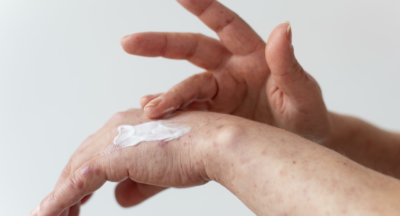 I migliori prodotti per la pelle secca: crema corpo, detergenti e consigli utili