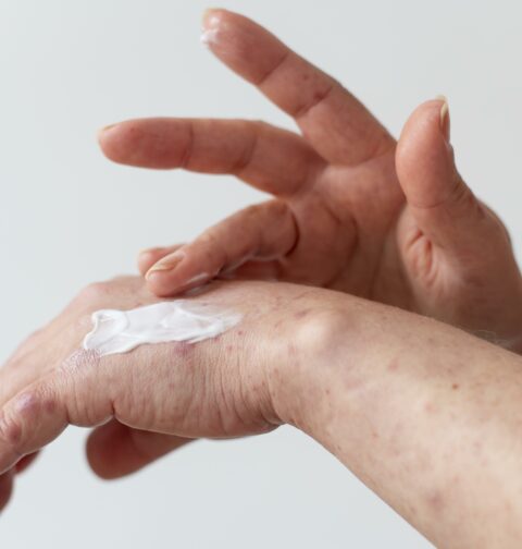 I migliori prodotti per la pelle secca: crema corpo, detergenti e consigli utili