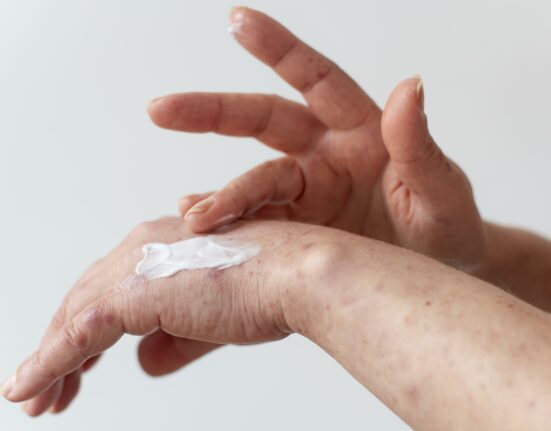 I migliori prodotti per la pelle secca: crema corpo, detergenti e consigli utili