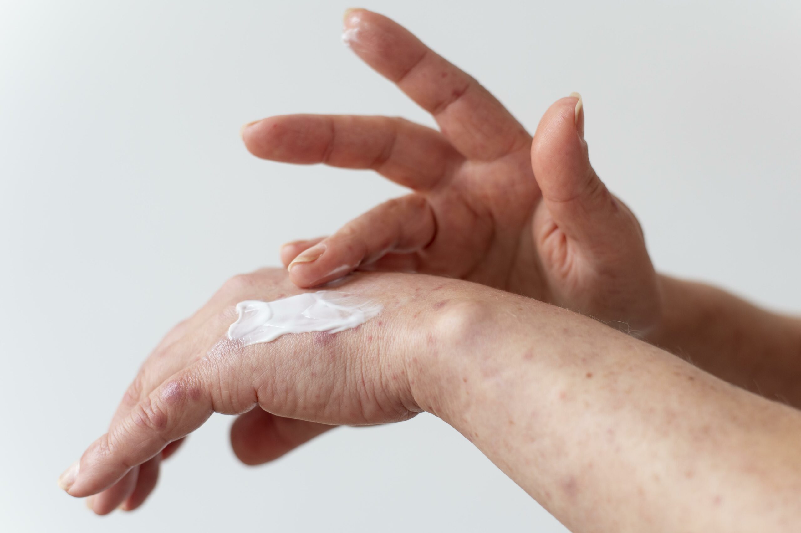 I migliori prodotti per la pelle secca: crema corpo, detergenti e consigli utili